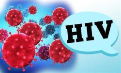 Trabalhador com HIV é indenizado por discriminação